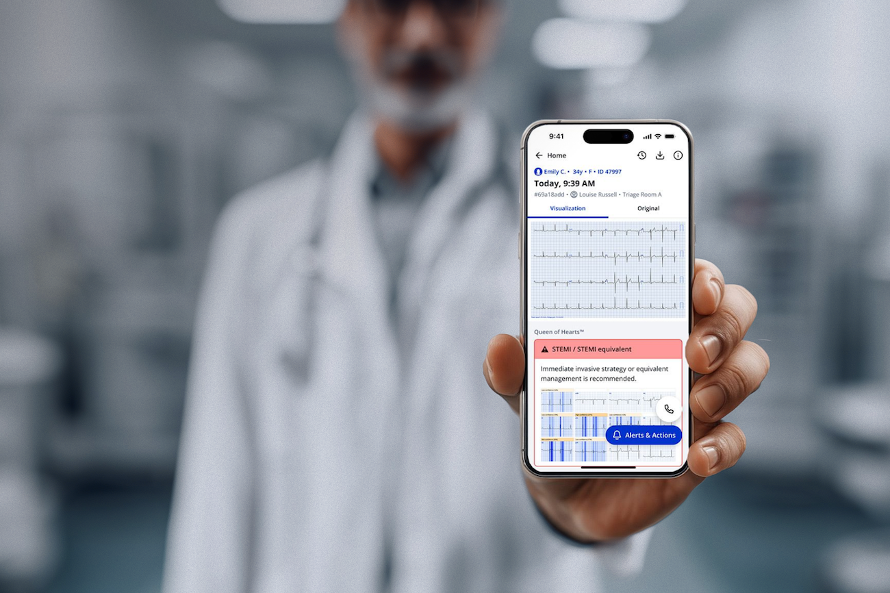 Article image for Tanner Health First in US to Use PMcardio AI Platform for Heart Attack Care