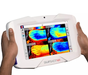 Healthliant Ventures and Kent Imaging Partner to Bring Real-Time Tissue Oxygenation Imaging to Tanner Health